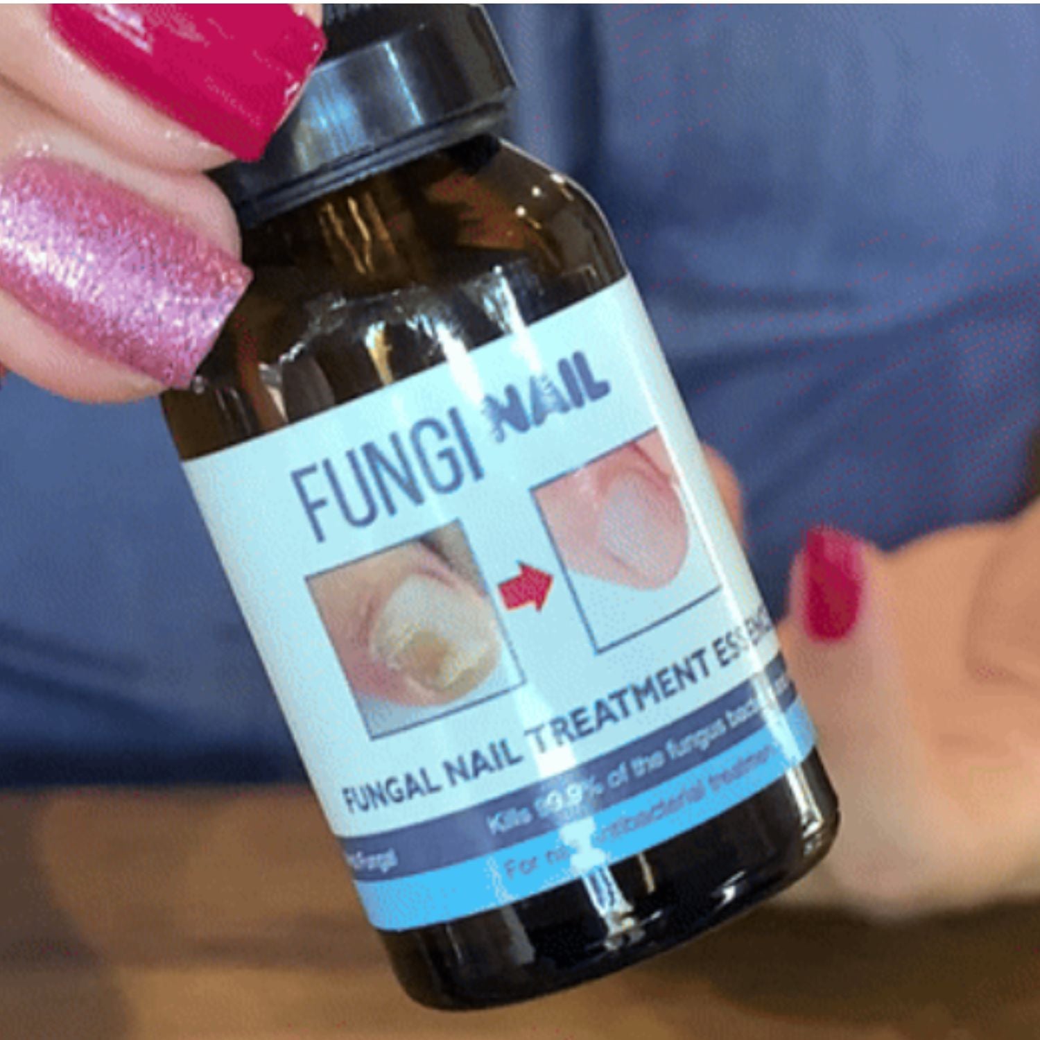 Fungi Nail