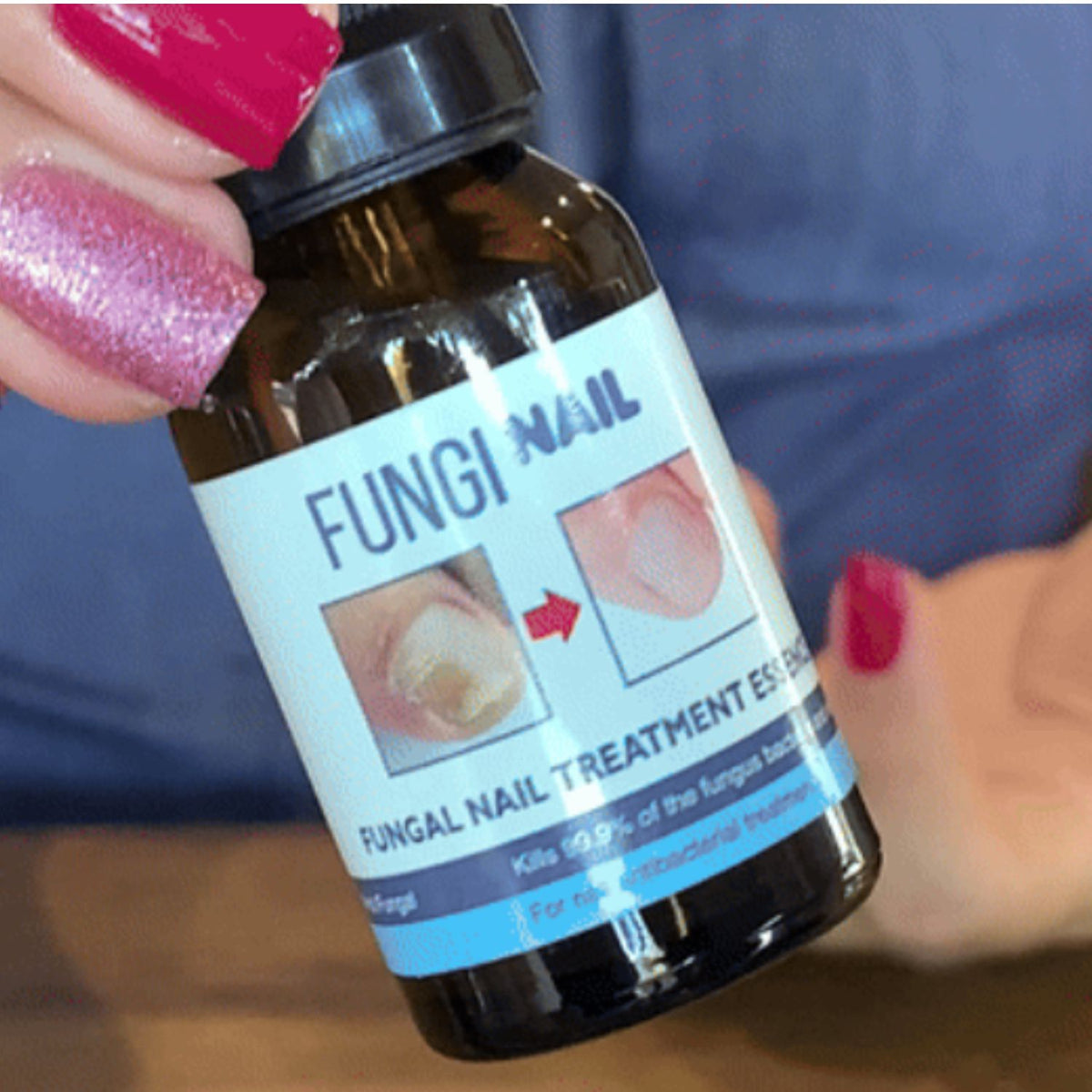Fungi Nail